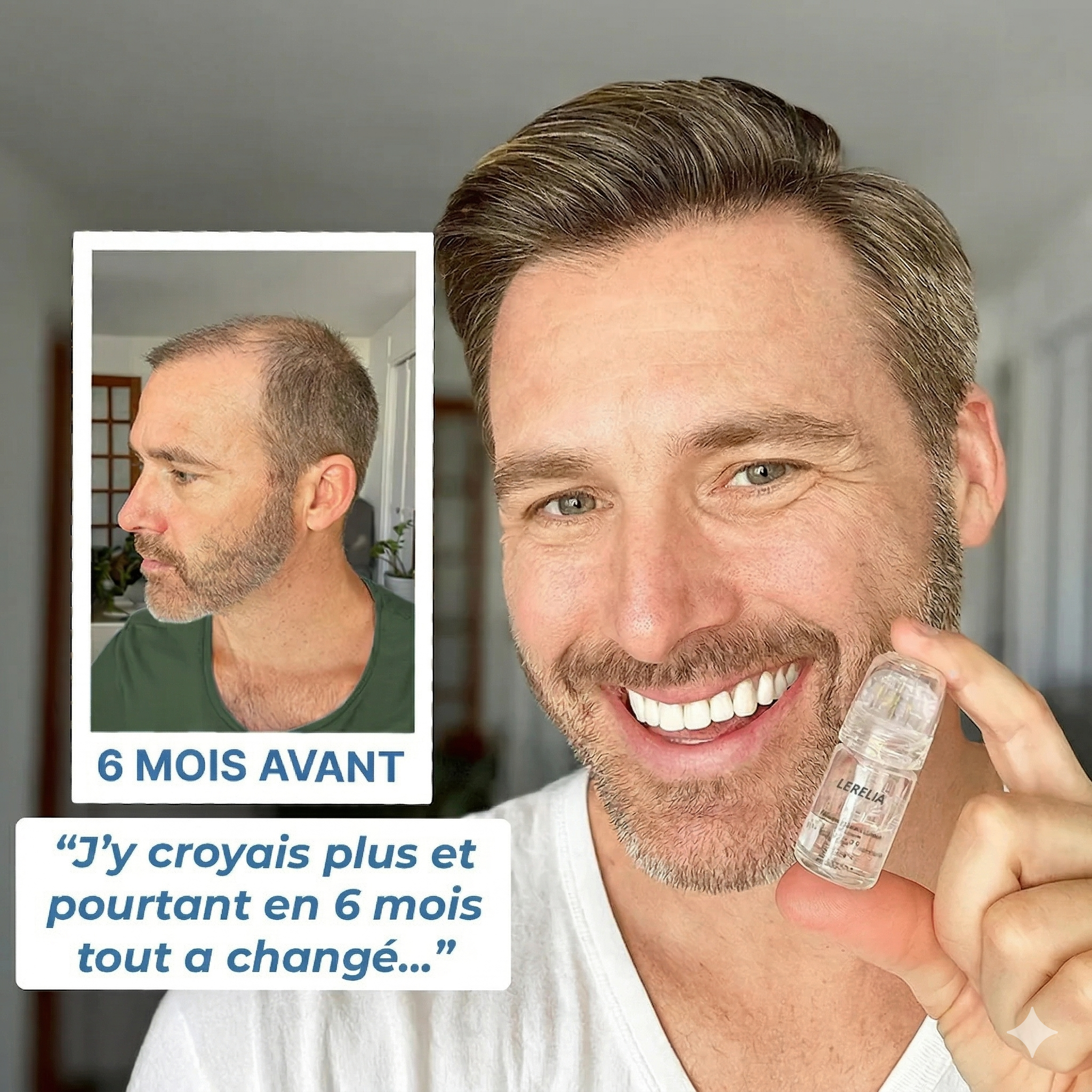 Haar-Mikroinfusions-System™