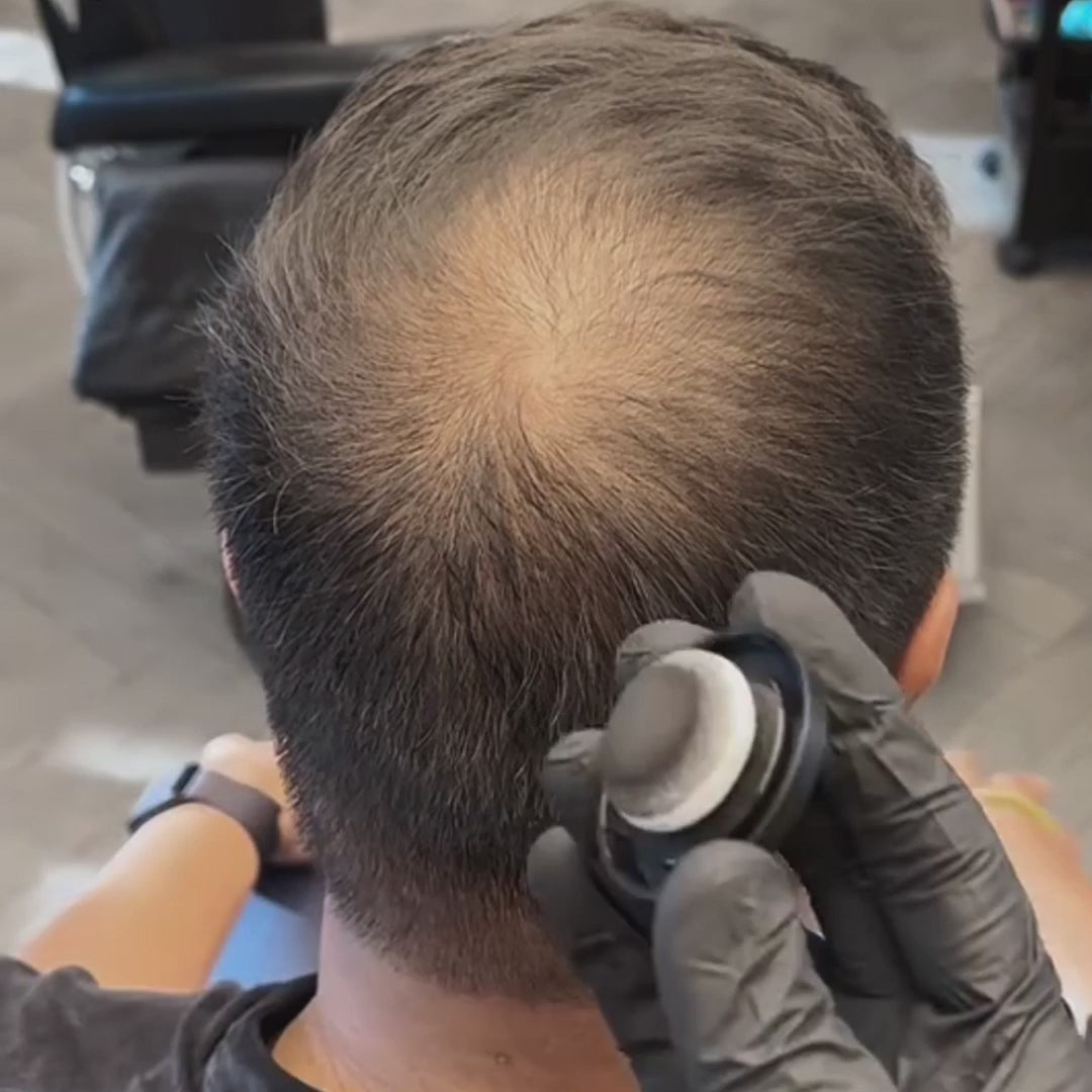 Haardichte-Füller™